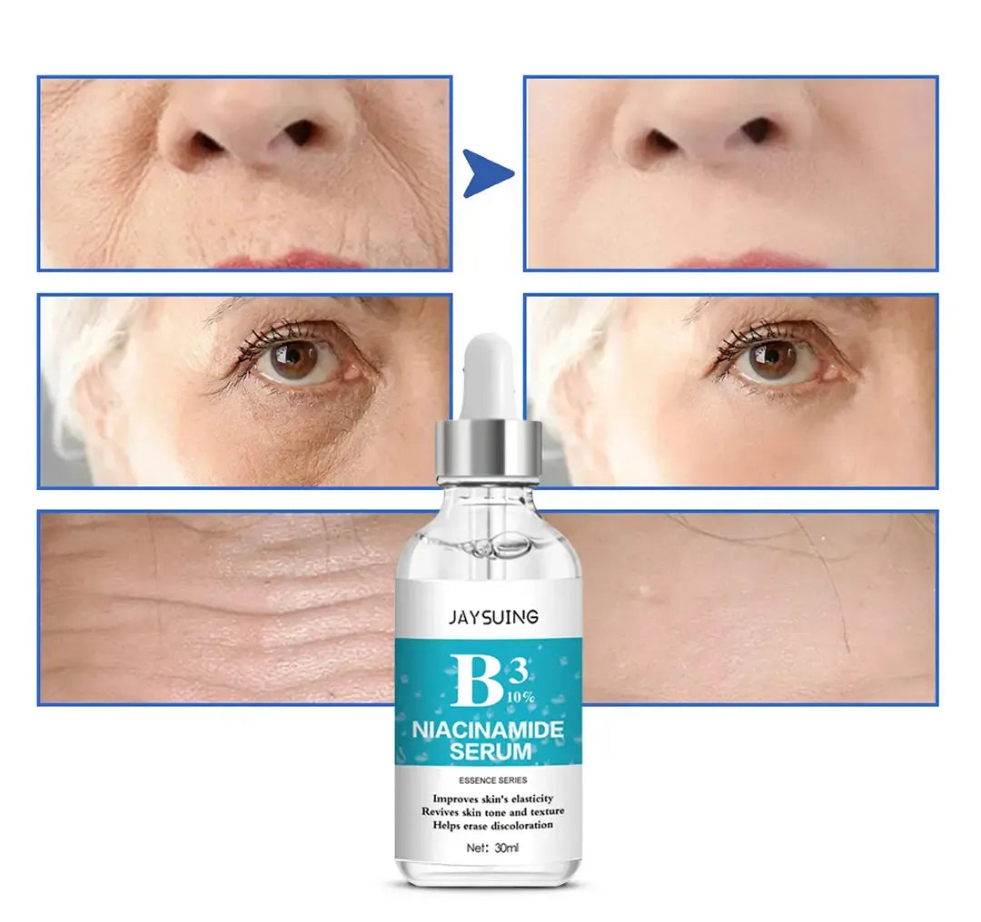 سيروم النياسيناميد الأكثر مبيعا في العالم لمكافحة الشيخوخة